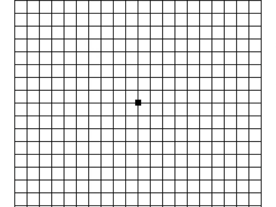 Amsler Grid and Retina Vision Test