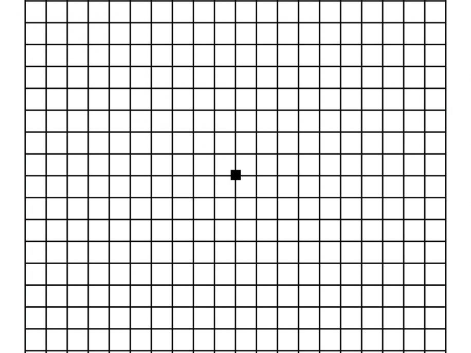 Amsler Grid and Retina Vision Test